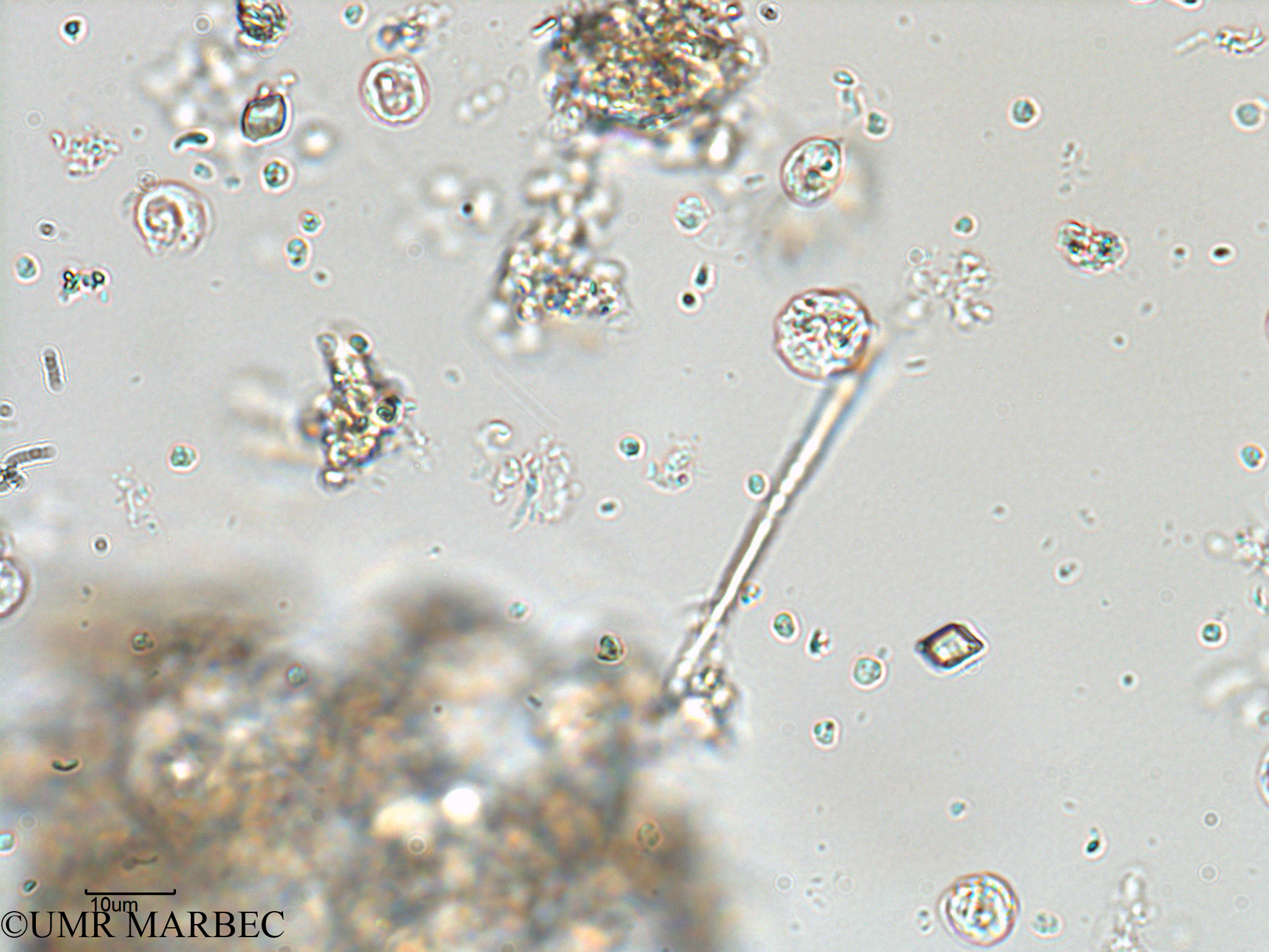 phyto/Bizerte/bizerte_lagoon/RISCO February 2015/Nanoflagellé 16 (ancien Lagune_T5-C1-Flag inf 10).tif(copy).jpg